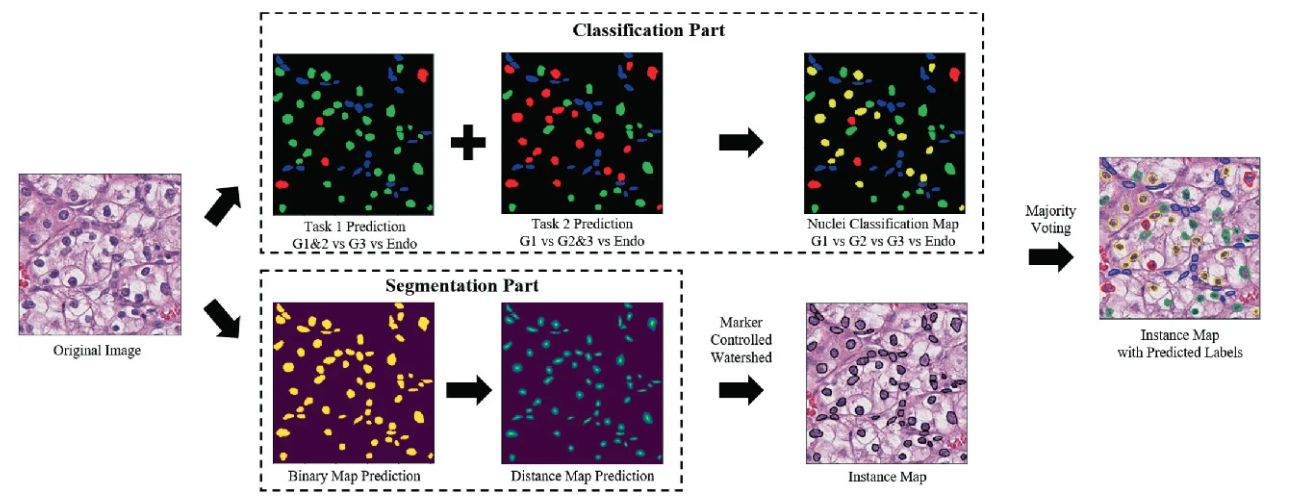 Nuclei Grading of Clear Cell Renal Cell Carcinoma in Histopathological Image by Composite High-Resolution Network