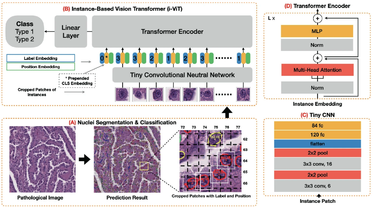 Instance-based vision transformer for subtyping of papillary renal cell carcinoma in histopathological image