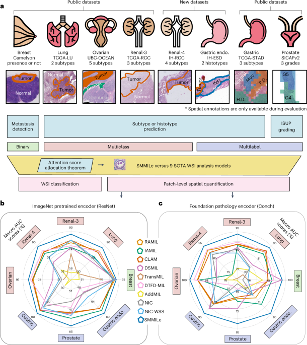 SMMILe enables accurate spatial quantification in digital pathology using multiple-instance learning
