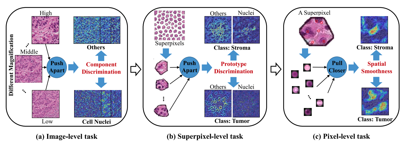 Unsupervised representation learning for tissue segmentation in histopathological images: From global to local contrast