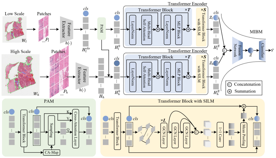MG-trans: Multi-scale graph transformer with information bottleneck for whole slide image classification